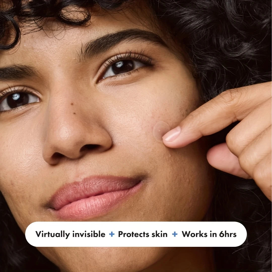 ملصقات حب الشباب – patches anti acne
