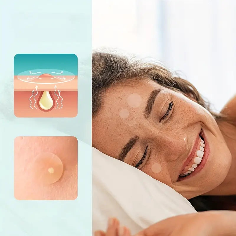 ملصقات حب الشباب – patches anti acne