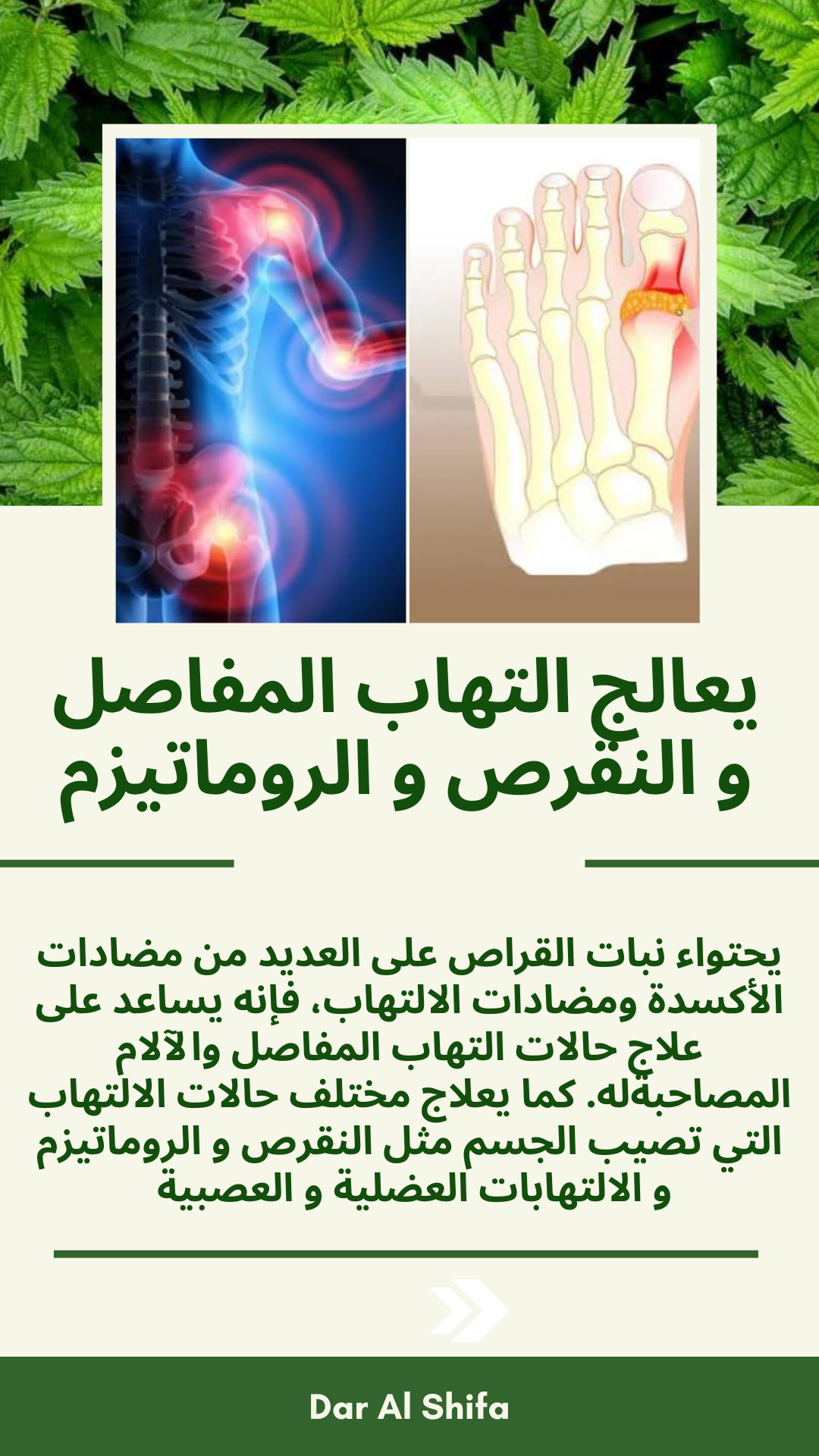 القراص