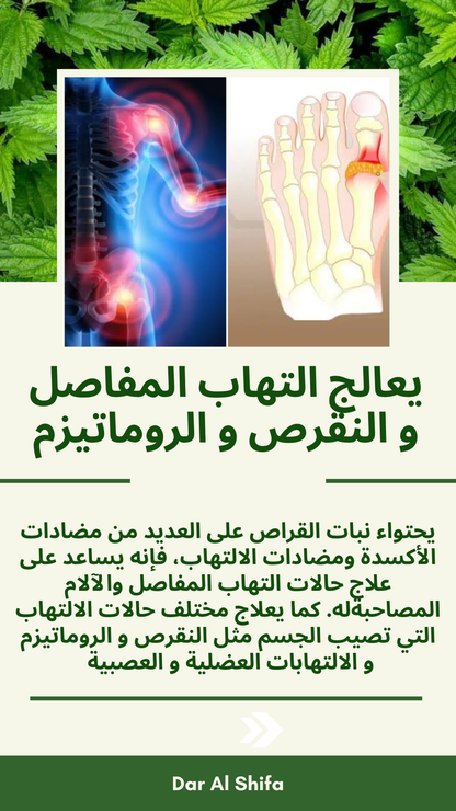 القراص