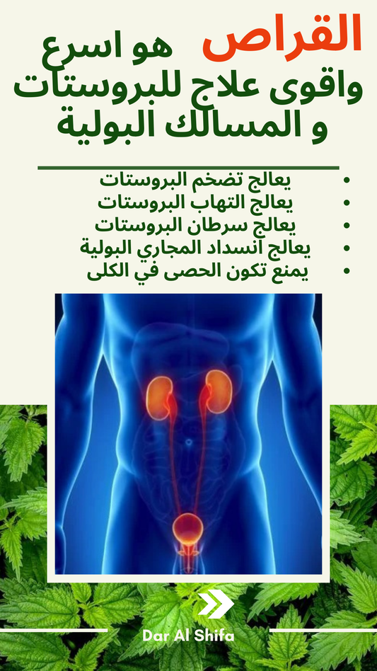 القراص