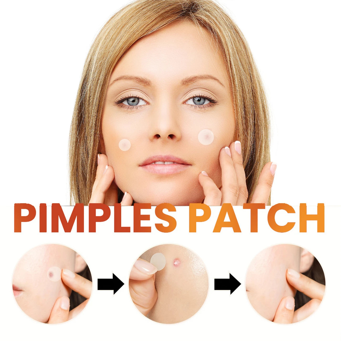 ملصقات حب الشباب – patches anti acne