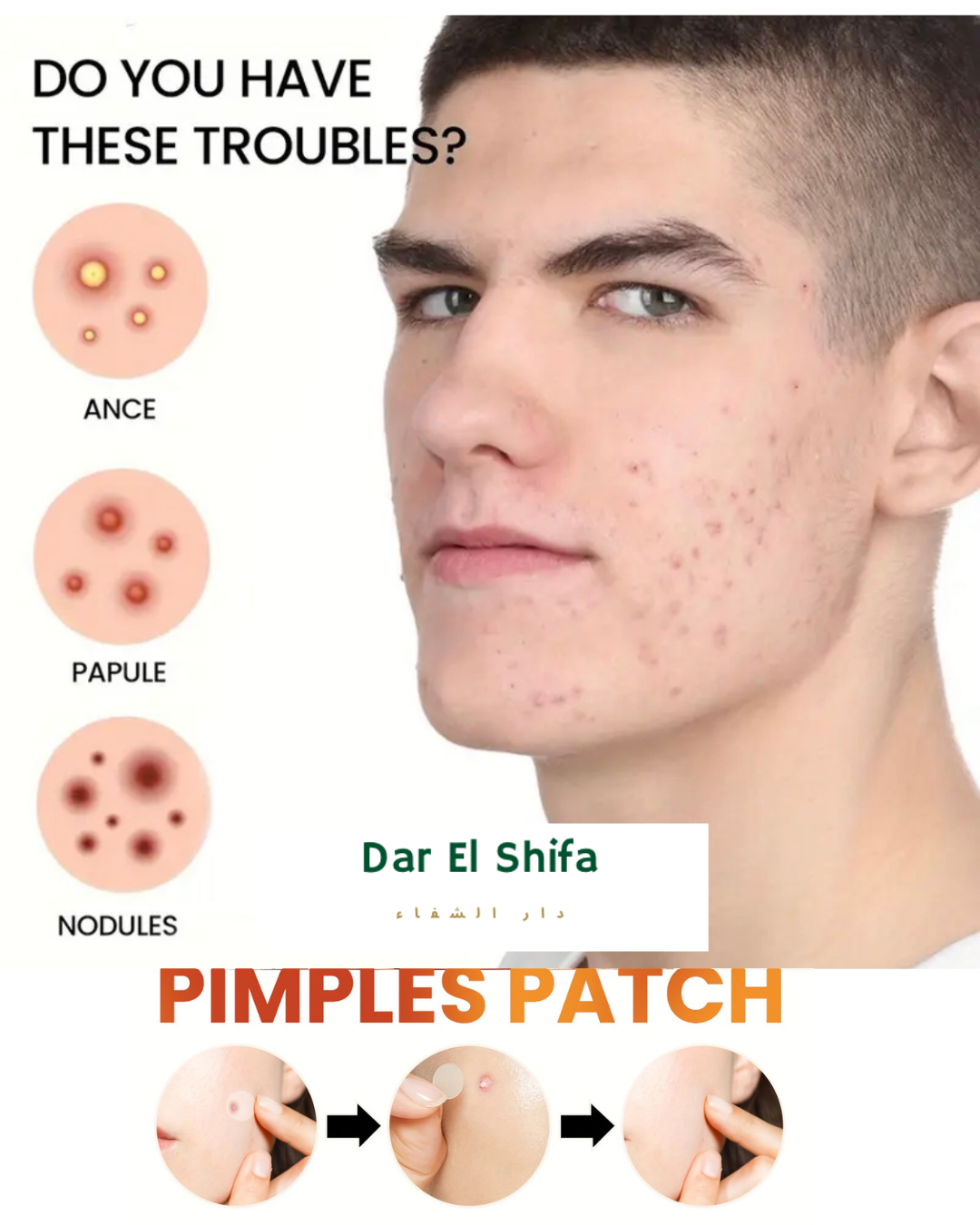 ملصقات حب الشباب – patches anti acne