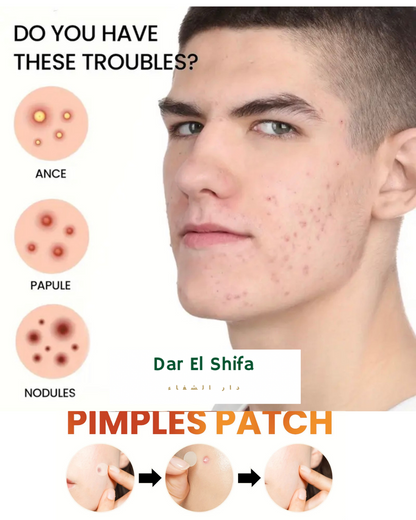 ملصقات حب الشباب – patches anti acne